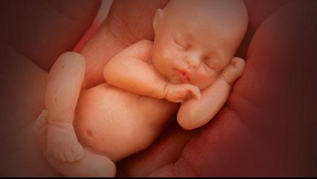 Reproduksi Bayi dengan Tiga Orang Tua Bisa Selamatkan Hidup