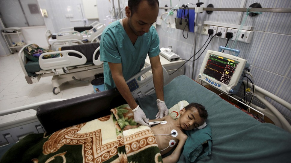 Hasil gambar untuk Anak-anak kelaparan di Yaman akibat perang